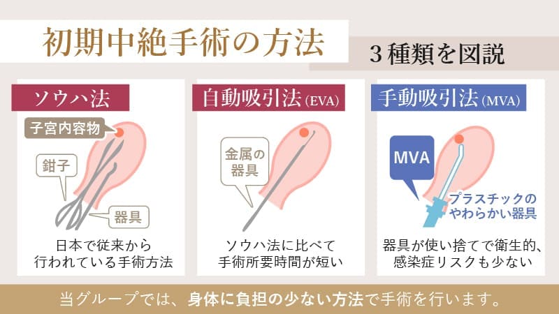 中絶手術の方法