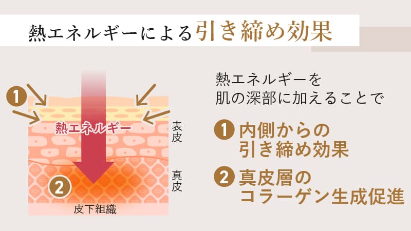 熱エネルギーによる肌の引き締め効果