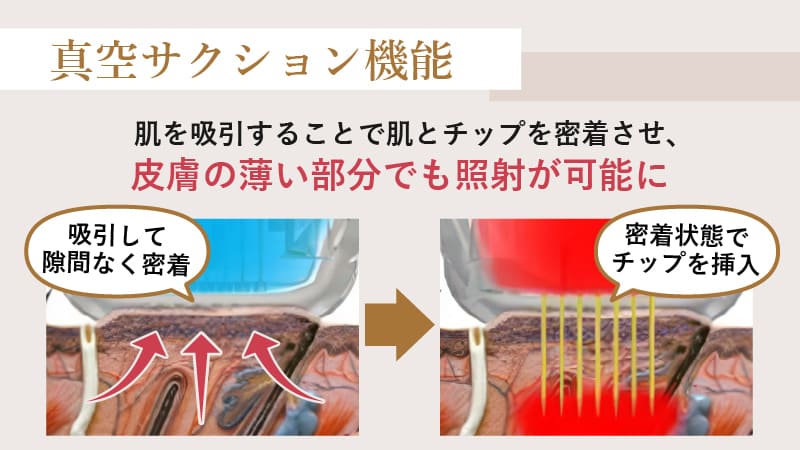 エリシスセンスの真空サクション機能