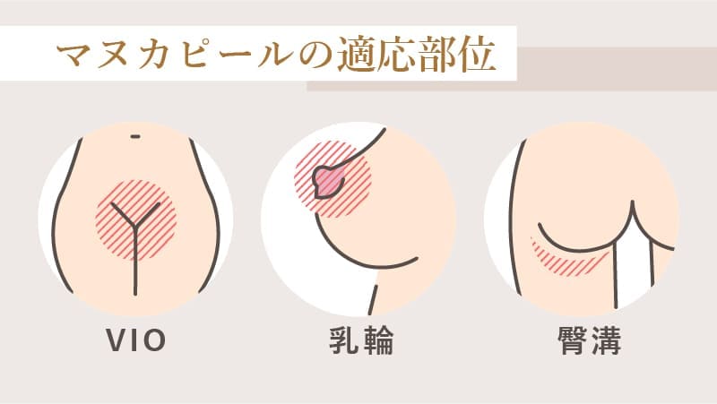 マヌカピールの適応部位