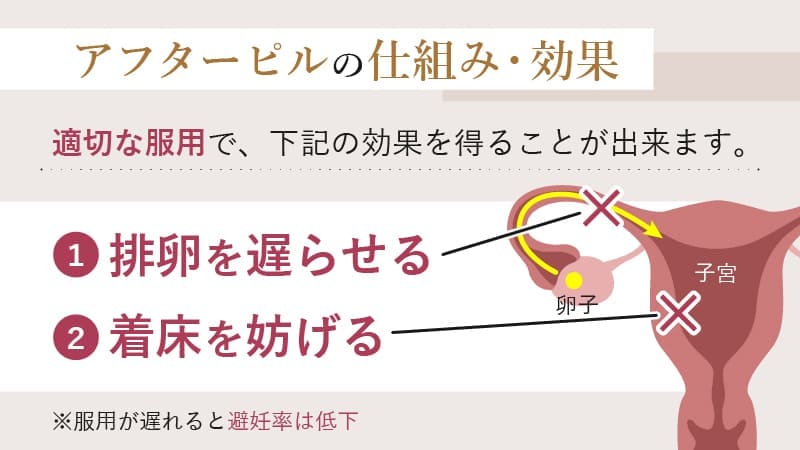 アフターピルの仕組みと効果