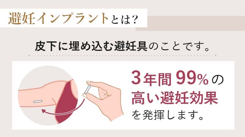 避妊インプラントとは