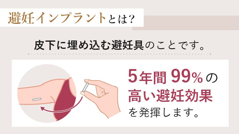 避妊インプラントとは